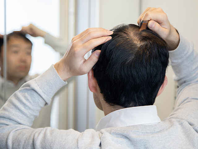 なぜ「薄毛」になってしまうのか？