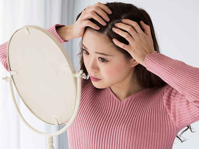 女性の薄毛の種類は何がある？