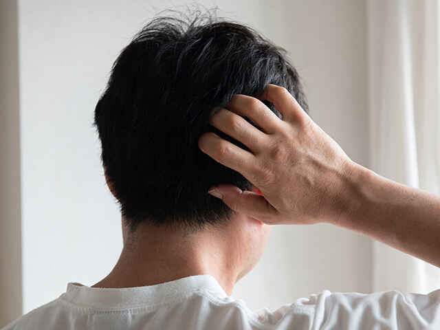 清潔にしているのにフケが出てくるのはなんで？