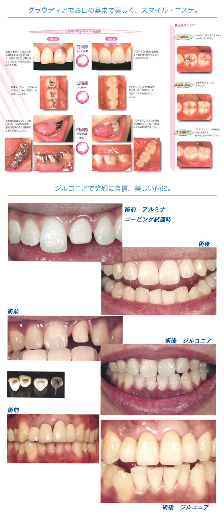 けやき歯科クリニックのお知らせ内容