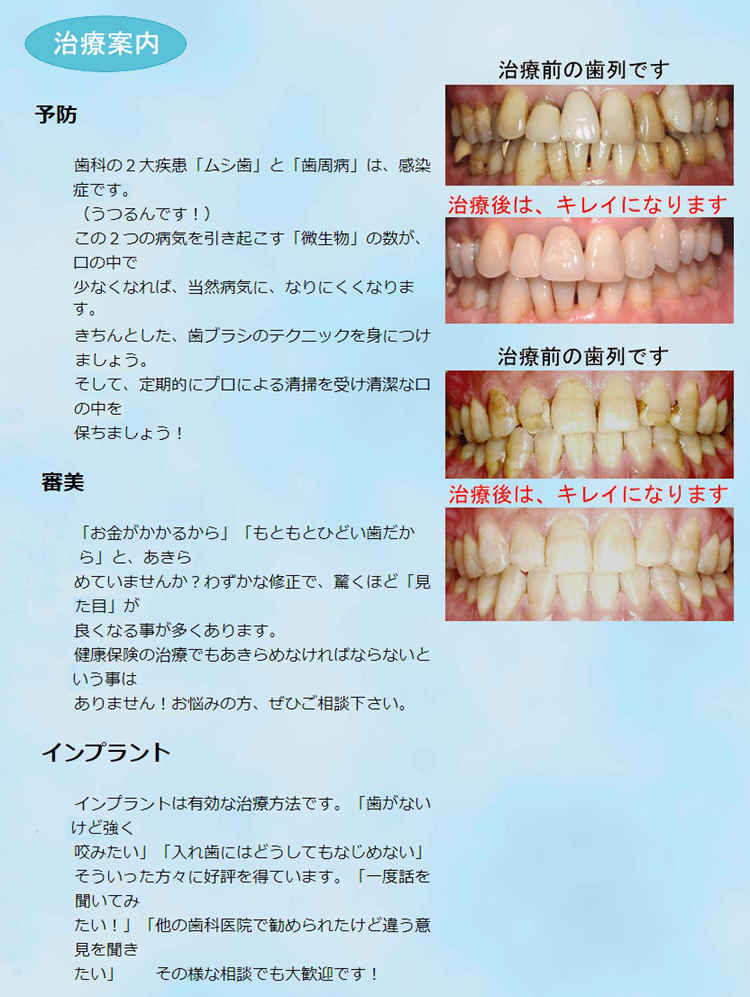 ヤマモトデンタルクリニック蒲田のお知らせ内容