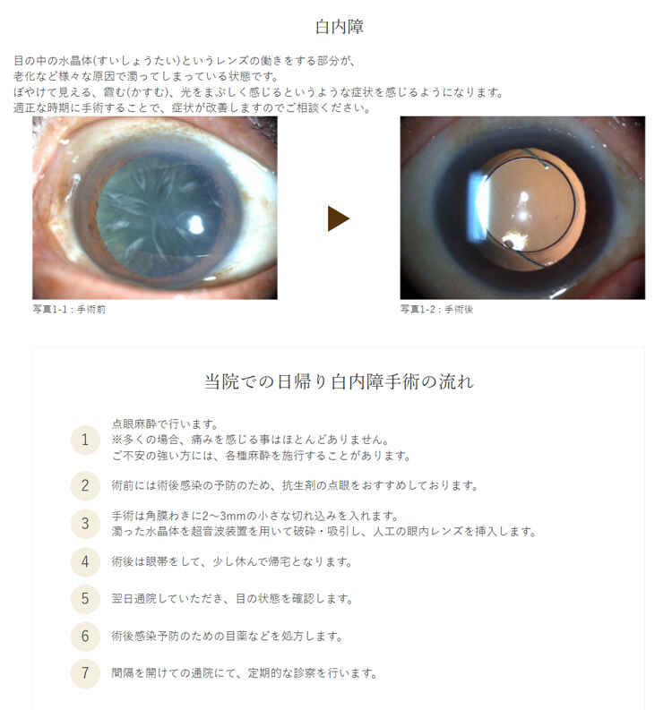 はせがわ眼科のお知らせ内容